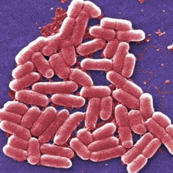 [VN] Vi khuẩn E.coli O157:H7