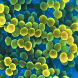[VN] Vi khuẩn Staphyloccal enterotoxins